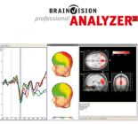 EEG Analysis Analyzer 2