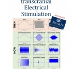 tDCS Transcranial Electrical Stimulation